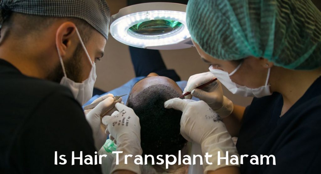 Is Hair Transplant Haram